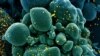 Imagine a unei celule (în verde) infestate cu noul coronavirus (în galben), realizată de cercetătorii americani